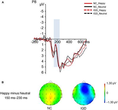 Unconscious Processing of Facial Expressions in Individuals with Internet Gaming Disorder